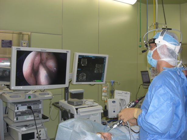 鼻腔がんに対するナビゲーションシステムを利用した手術